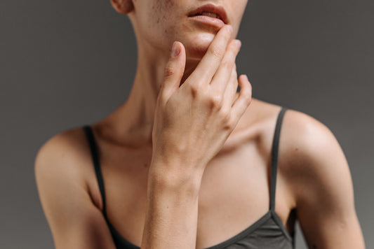 Why Does the Same Skincare That Worked All Summer Suddenly Stop Working?